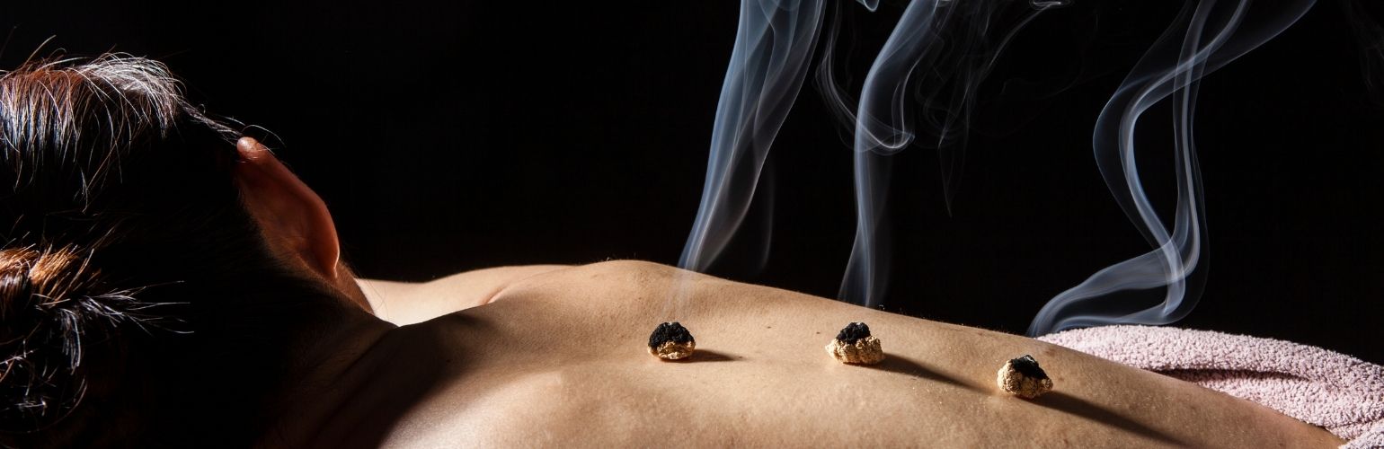 aijiu moxibustion